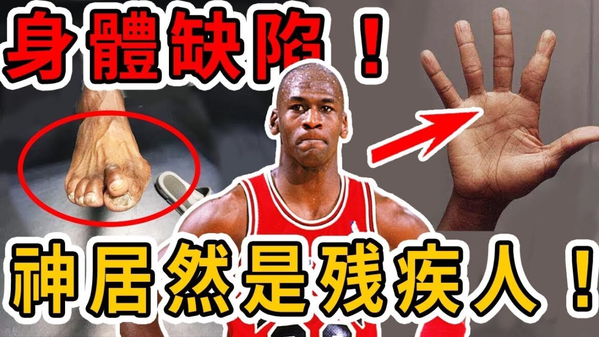 難以想象!身體畸形還患有先天身體缺陷,卻還拿下三連冠!那些有身體缺陷的NBA球星…… 難以想象!身體畸形還患有先天身體缺陷,卻還拿下三連冠!那些有身體缺陷的NBA球星……