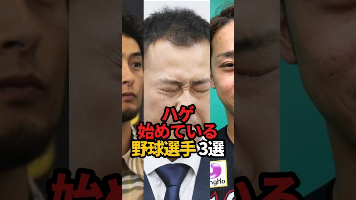 ハゲ始めている野球選手 3選#shorts #野球 #プロ野球 #野球ネタ #やきゅスト