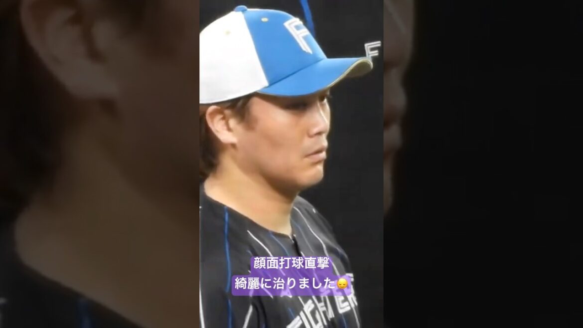 伏見寅威　顔面打球直撃で顔が真っ黒に…秋季キャンプでは腫れがひいてました‼︎ #プロ野球 #北海道日本ハムファイターズ