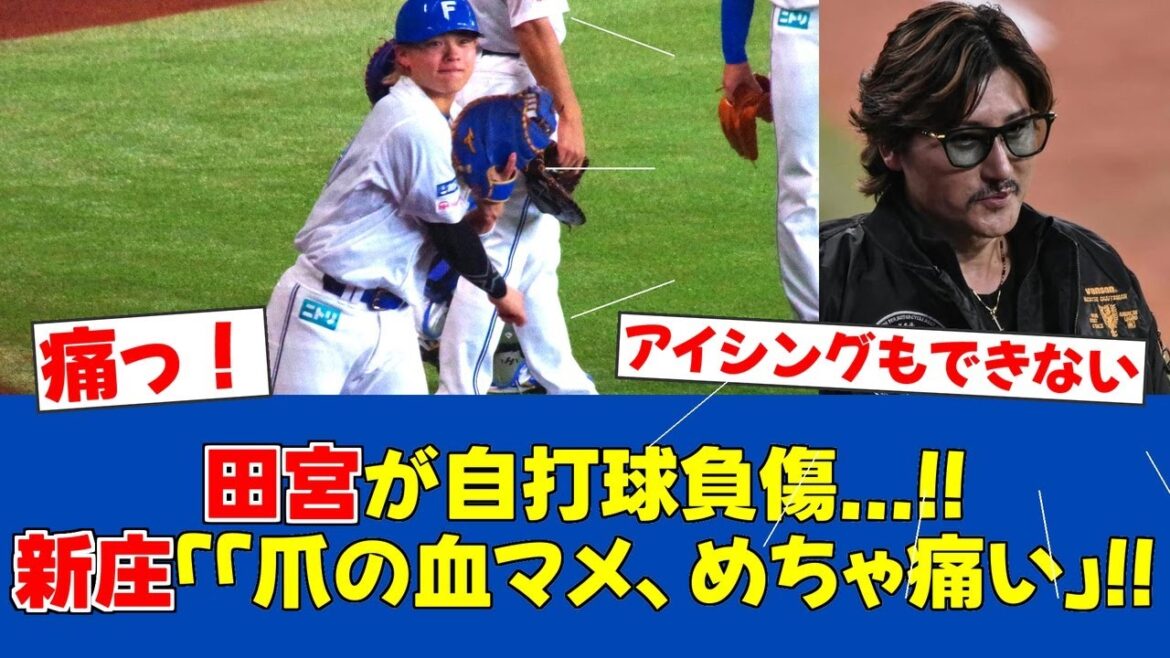 【悲報】田宮裕涼 自打球で負傷交代！新庄監督「爪の血マメ」【日ハムファンの反応】【F速報】