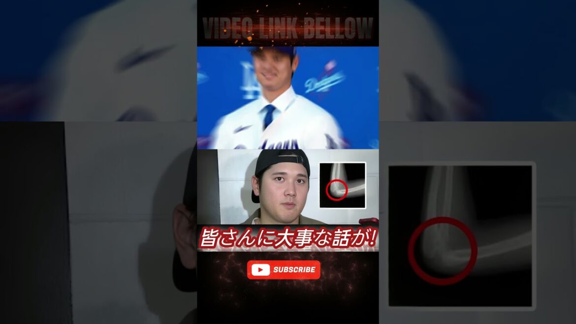 【緊急速報】「リハビリ中に   」大谷翔平の投手復帰に関して緊急事態！大谷の執刀医が告白した右肘の現在   今後についての重大告知に世界中が驚愕！【海外の反応 米国の反応 MLB】M2