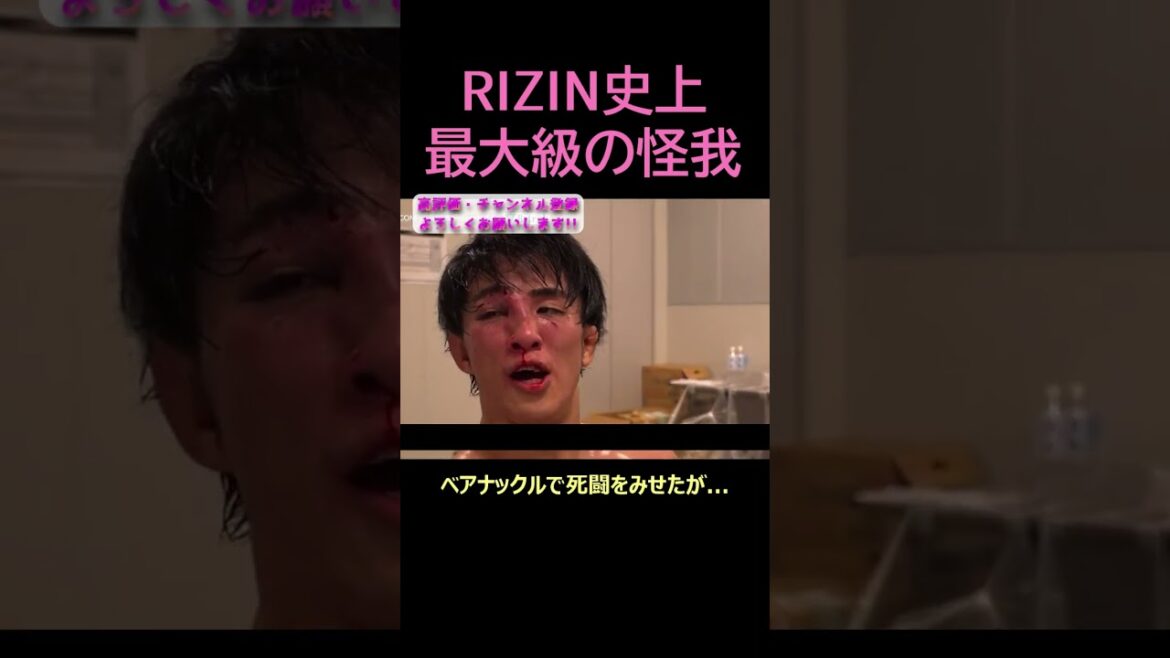 RIZIN史上最大レベルの怪我をしてしまう征矢... #征矢貴 #ベアナックル #ジョンドッドソン #超rizin3 #rizin #shorts #ライジン #切り抜き
