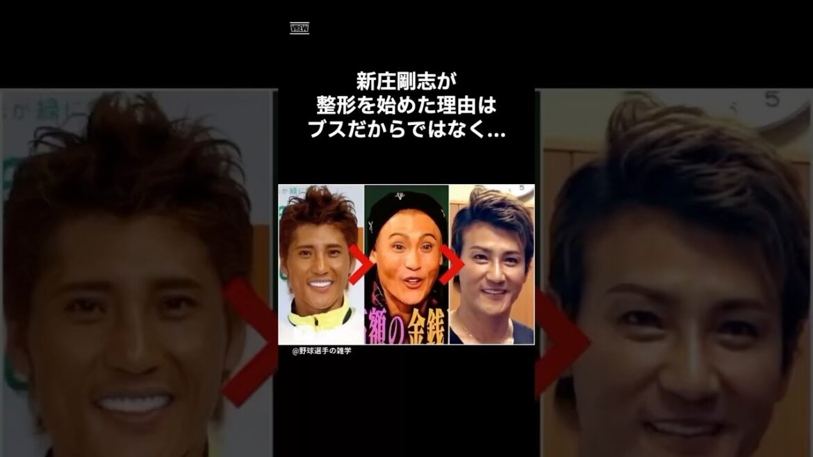 新庄剛志が整形する本当の理由　#shorts #野球 #野球雑学 #雑学 #プロ野球 #メジャーリーグ #新庄剛志 #日ハム