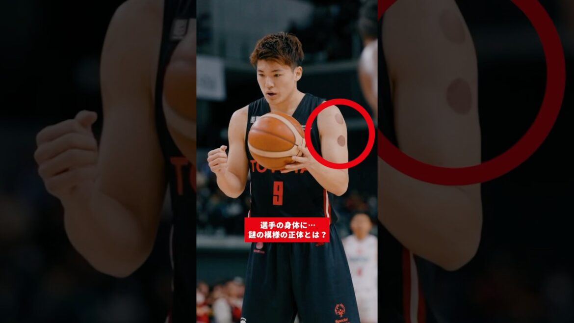 皆さんも気になっていた“あの模様”🤔「カッピング」と呼ばれる治療法！#アルバルク東京 #バスケ #Bリーグ #basketball