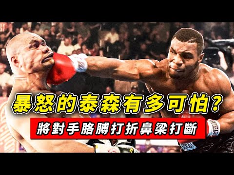 暴怒的泰森有多可怕?重拳將對手胳膊打折,鼻梁打斷現場搶救! 暴怒的泰森有多可怕?重拳將對手胳膊打折,鼻梁打斷現場搶救!
