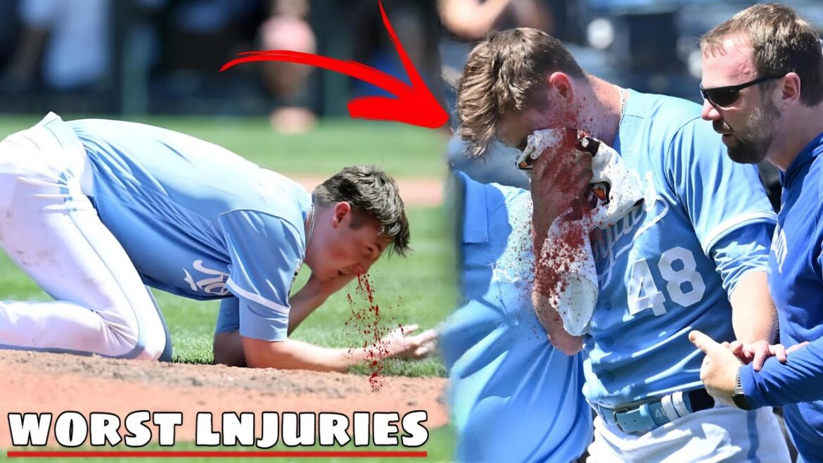 MLB• Scary lnjuries Part3 MLB• Scary lnjuries Part3
