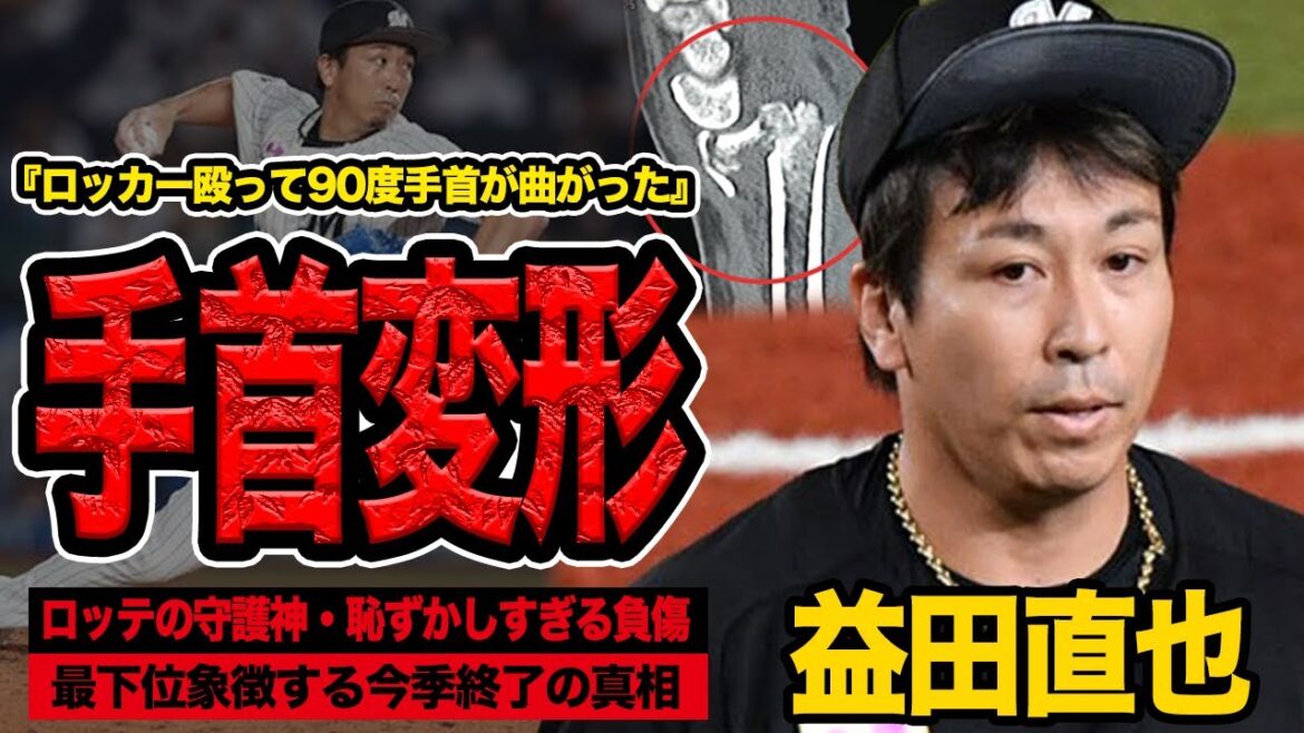 益田直也の手首が変形…ロッカーをぶん殴って今季終了となった衝撃の舞台裏に言葉を失う!【千葉ロッテマリーンズ】【プロ野球】 益田直也の手首が変形…ロッカーをぶん殴って今季終了となった衝撃の舞台裏に言葉を失う!【千葉ロッテマリーンズ】【プロ野球】
