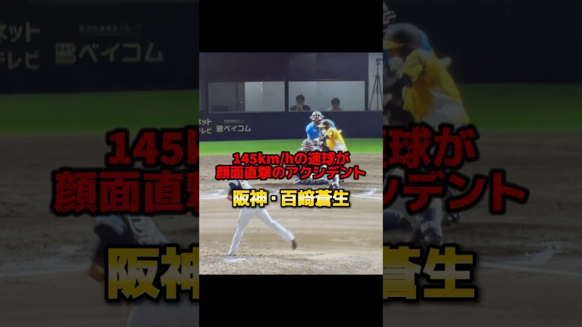下顎骨骨折だった…