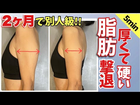 #1646【原因は肩関節】僧帽筋と三角筋が硬いと腕は一生痩せません。分厚い肩の脂肪を削ぎ落とす「腕痩せ」エクササイズ #1646【原因は肩関節】僧帽筋と三角筋が硬いと腕は一生痩せません。分厚い肩の脂肪を削ぎ落とす「腕痩せ」エクササイズ